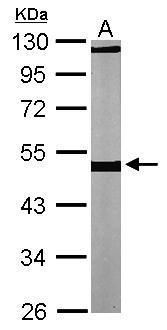 tubulin beta 1 class VI Antibody
