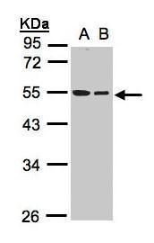 tubulin beta 1 class VI Antibody