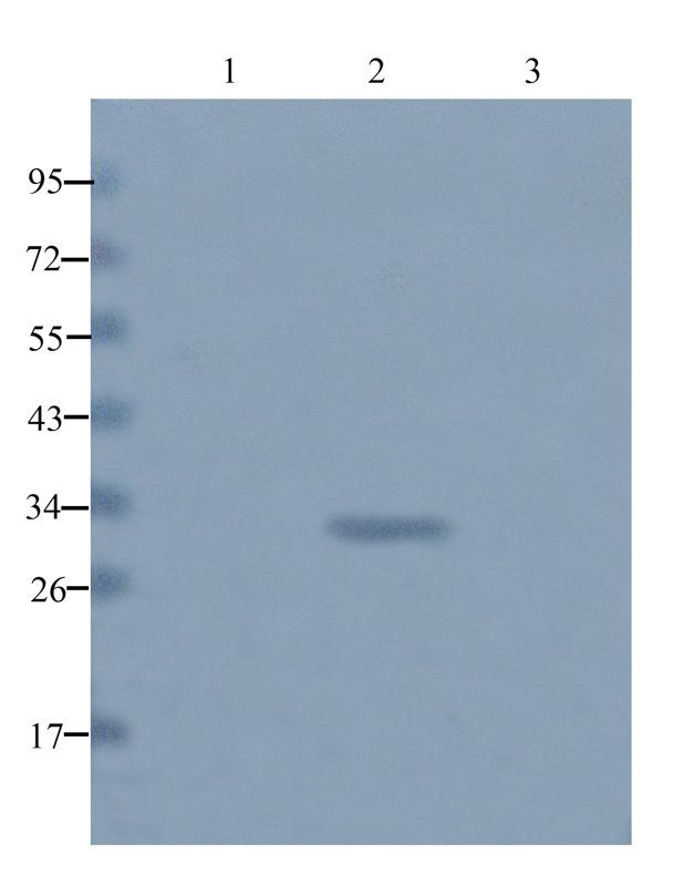 beta 1 Adrenergic Receptor antibody