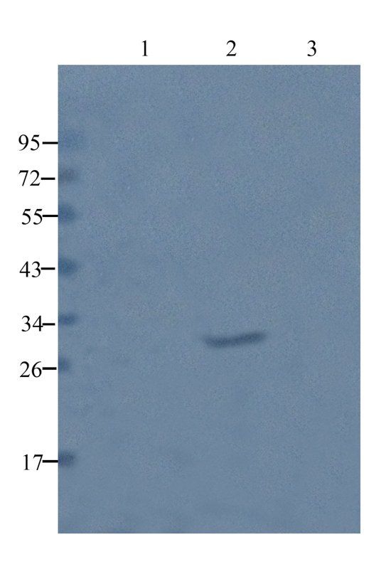 beta 1 Adrenergic Receptor antibody