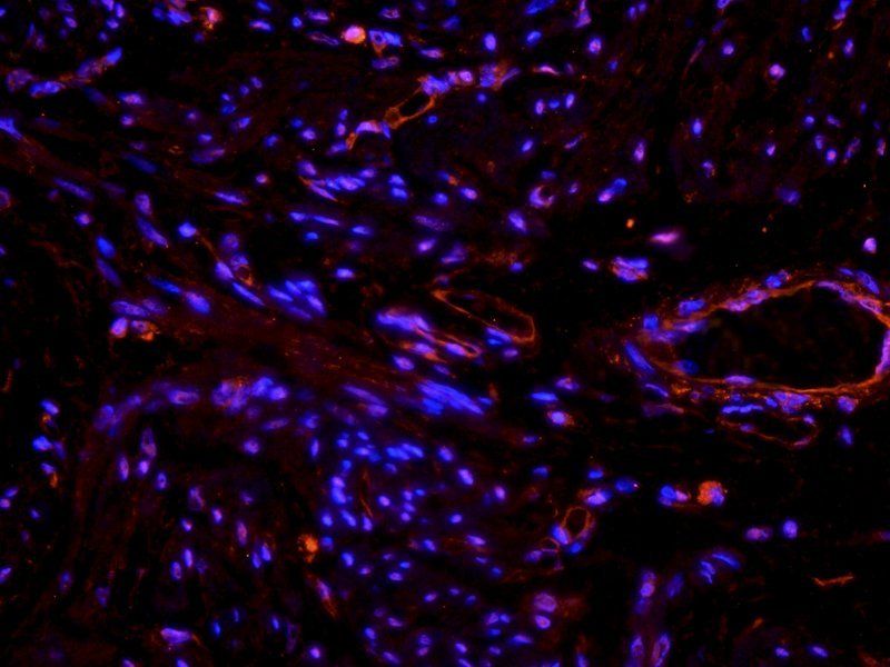 beta 1 Adrenergic Receptor antibody