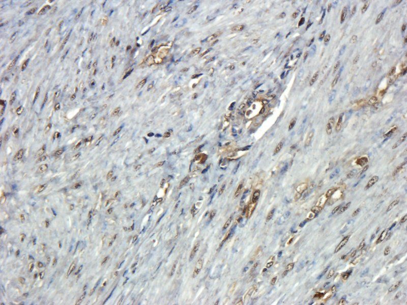 beta 1 Adrenergic Receptor antibody