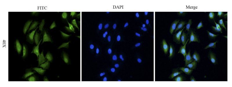 beta Actin antibody (FITC)