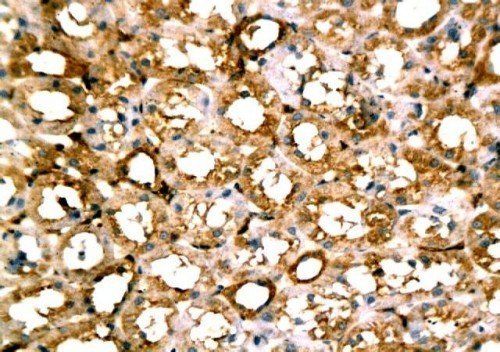 beta Actin antibody