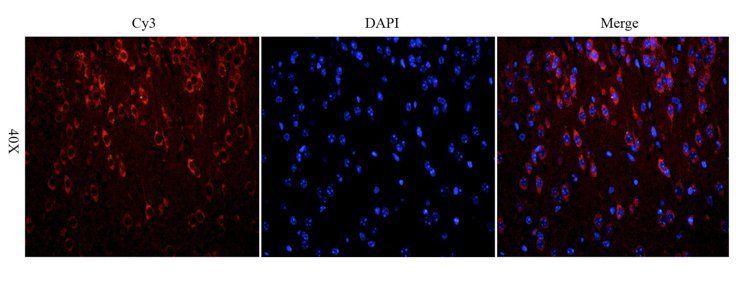 beta Actin antibody