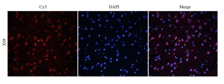 beta Actin antibody