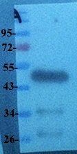 beta Actin antibody