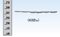 Beta Amyloid 1-40 Mouse Polyclonal Antibody