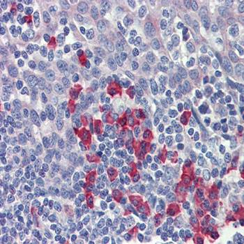 beta-Amyloid antibody