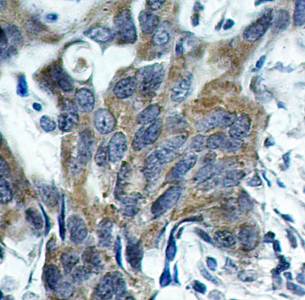 β-Catenin (Phospho-Ser33) Antibody