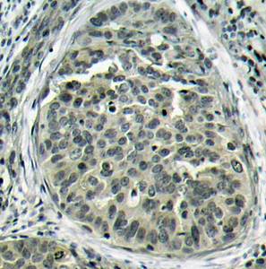 β-Catenin (Phospho-Ser37) Antibody