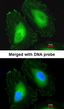 Beta-crystallin A4 Rabbit Polyclonal Antibody