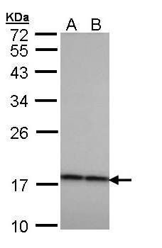 Beta-crystallin A4 Rabbit Polyclonal Antibody