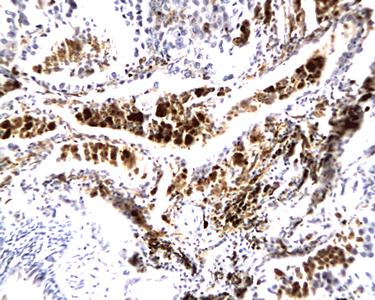 alpha MSH antibody