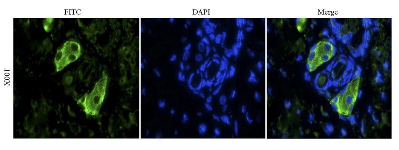 alpha MSH antibody