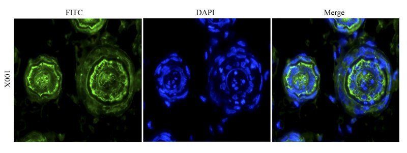 alpha MSH antibody