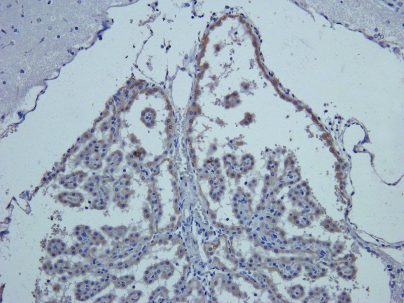 beta Endorphin antibody