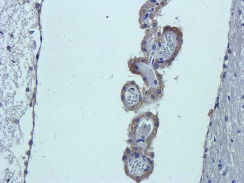 beta Endorphin antibody