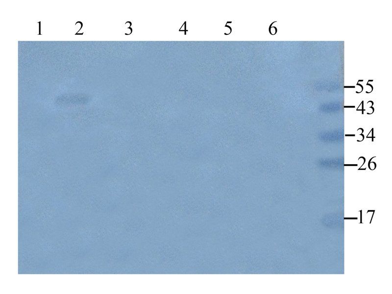 beta Endorphin antibody