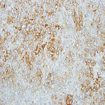 beta-glucosidase antibody