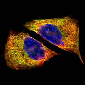 beta IV Tubulin antibody