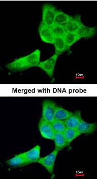 beta Tubulin 3 antibody