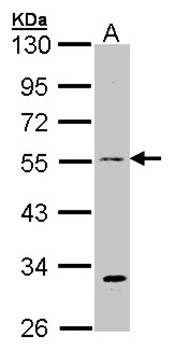 beta Tubulin 3 antibody