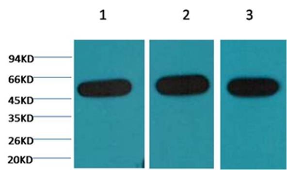 β-tubulin Mouse Monoclonal Antibody