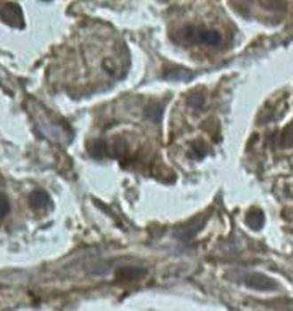 Beta Actin Rabbit Polyclonal Antibody