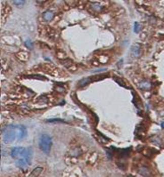 Beta tubulin Rabbit Polyclonal Antibody