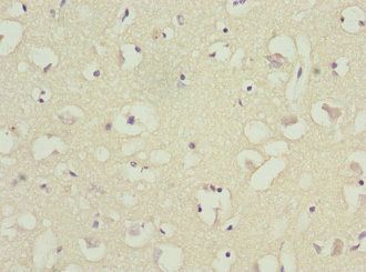 BFAR Antibody