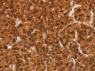 BFAR Antibody