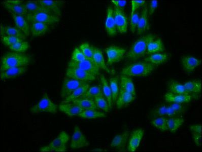 BFSP2 Antibody