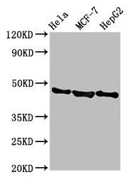BFSP2 Antibody