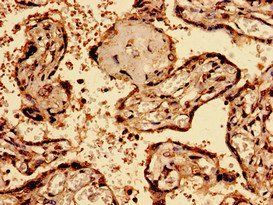 BGN Antibody