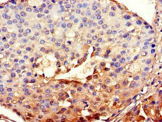 BHLHE40 Antibody