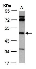 betaine--homocysteine S-methyltransferase Antibody