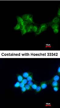 betaine-homocysteine methyltransferase antibody