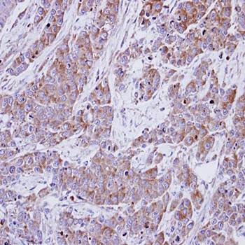 betaine-homocysteine methyltransferase antibody