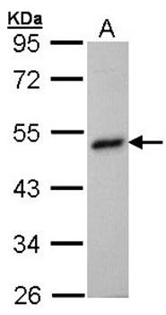 betaine-homocysteine methyltransferase antibody