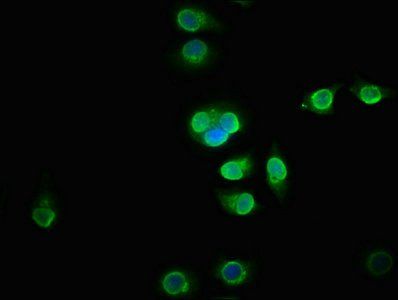 BICC1 antibody