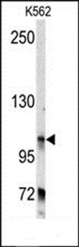BICD2 antibody