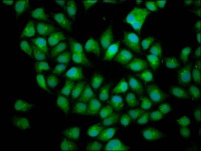 BICD2 Antibody