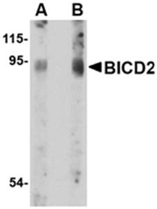 BICD2 Rabbit Polyclonal Antibody