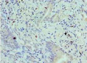 BIK Antibody