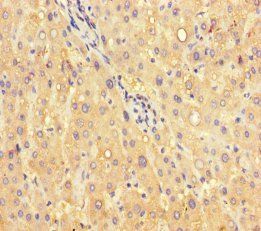 NR1H4 Antibody