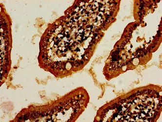 NR1H4 Antibody