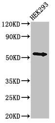 Bile acid R antibody