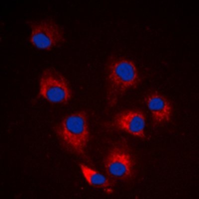 BIM (phospho-S69) antibody