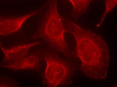 BIM (Phospho-Ser69) Antibody